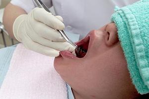 歯の美しさを取り戻す！セラミック治療で実現する渋谷の歯科クリニック