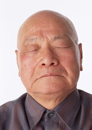 インプラント治療という選択もあります